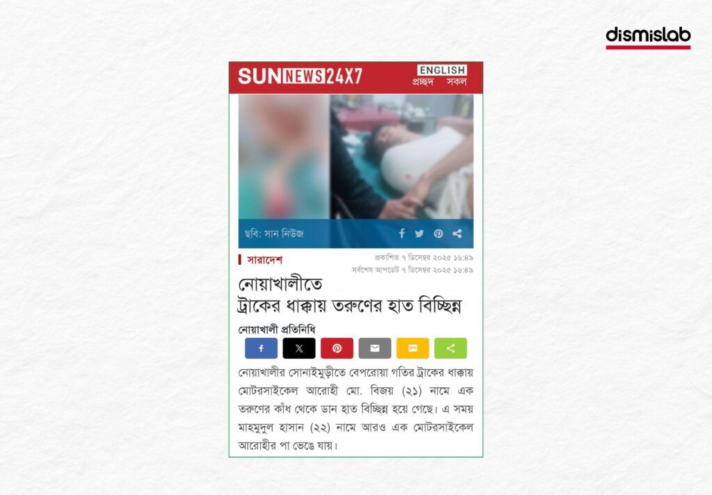 ছাত্রলীগ করায় হাত কেটে ফেলেছে দাবি, অথচ বিচ্ছিন্ন হয়েছে ট্রাকের ধাক্কায়