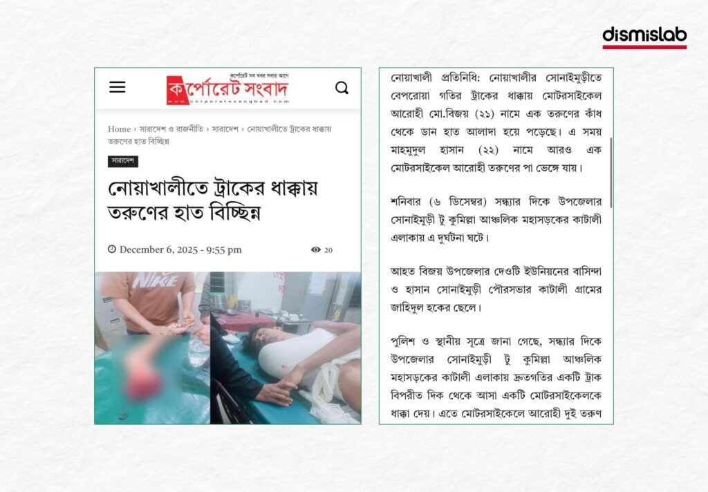 ছাত্রলীগ করায় হাত কেটে ফেলেছে দাবি, অথচ বিচ্ছিন্ন হয়েছে ট্রাকের ধাক্কায়
