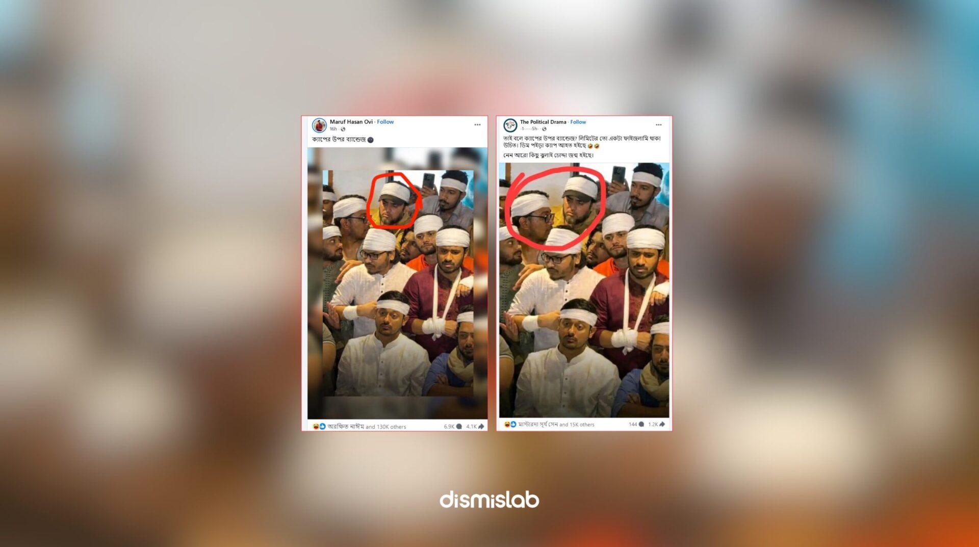 Fact-check confirming the viral Facebook photo showing bandages on everyone at Nasiruddin Patwary’s press conference was digitally edited and misleading