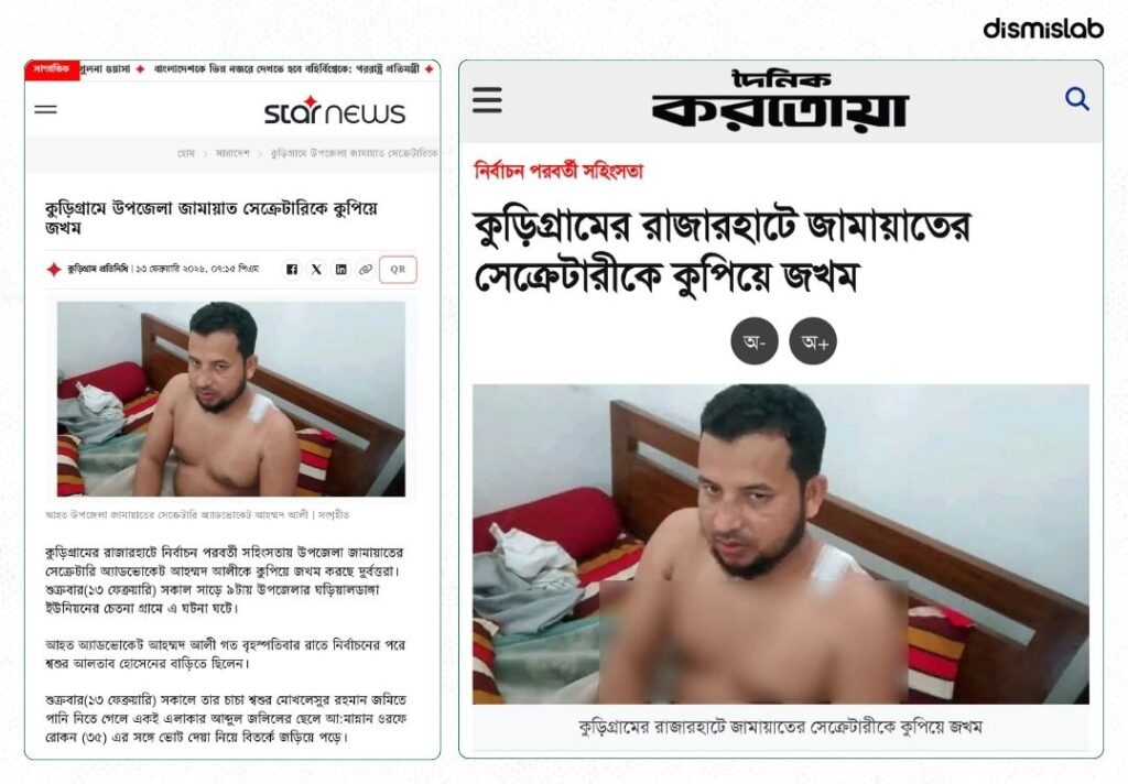 দাবি বিএনপি নেতার ওপর হামলা, অথচ তিনি জামায়াতের উপজেলা সেক্রেটারি ফ্যাক্ট চেক