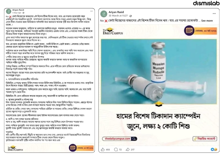 হাম টিকা নিয়ে গুজব: হামের টিকার বদলে থুতু মালিশের পরামর্শ, ছড়ানো হচ্ছে ষড়যন্ত্র তত্ত্বও