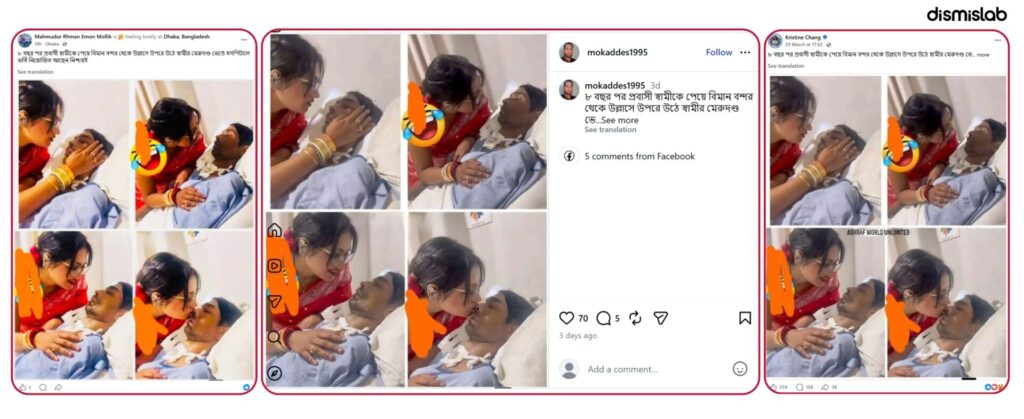 Fact-check: Viral images falsely claim a man’s spine was broken by his wife at an airport reunion after 8 years abroad; actually show Indian accident victim Sarbatrik Chatterjee in coma after a road crash.