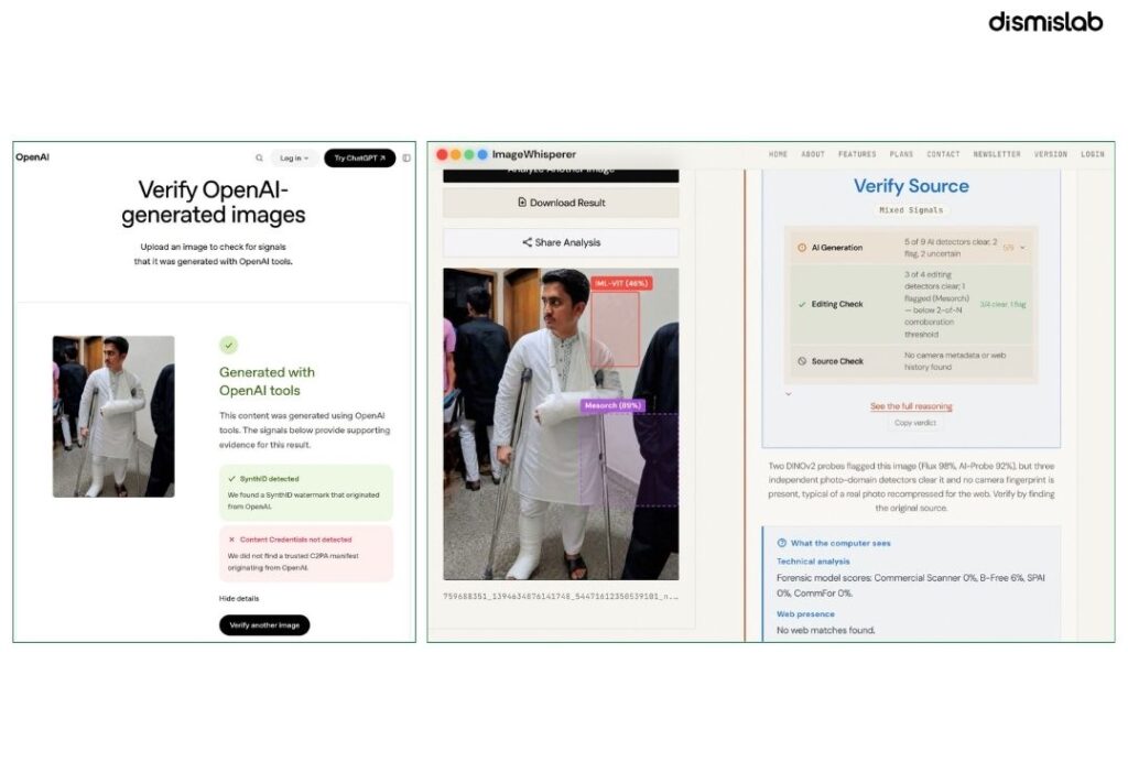 Photo of Sarjis Alam in bandages holding crutches is AI-edited