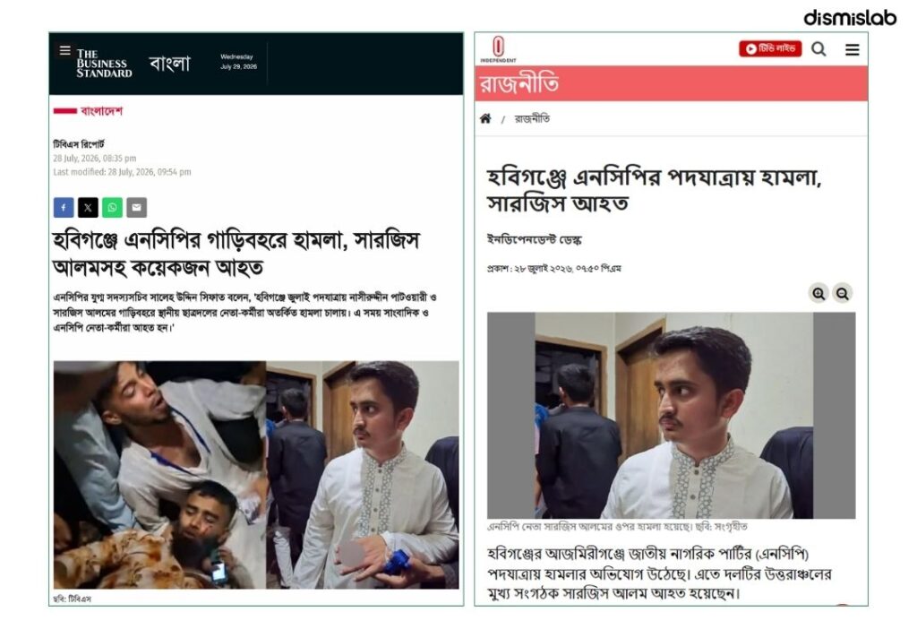 Photo of Sarjis Alam in bandages holding crutches is AI-edited